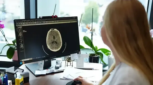 kume bas agrisi nedir belirtileri nelerdir uzmanindan onemli uyarilar zkxwdONT.webp