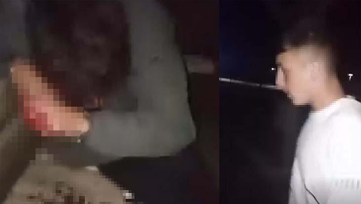 lise ogrencileri arasinda kanli kavga arkadasini parka cagirarak darbetti OV7mpz6B