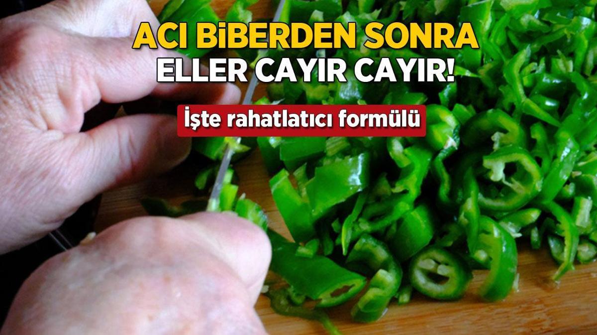 aci biber sonrasi eller cayir cayir yaniyor iste rahatlatici formulu IZb57hbT.jpg