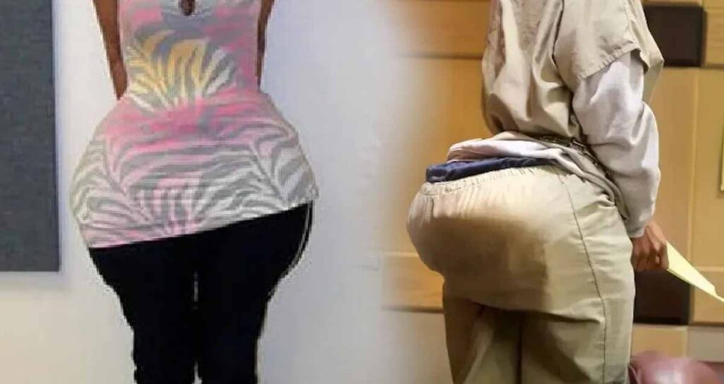 dolgu-diye-kalcalarina-cimento-ve-macun-basmislar-F5vSf1al